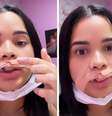 Eryka Costa precisou levar 10 pontos no ferimento e deve passar por reconstrução  Foto: Reprodução/Instagram
