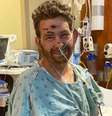 Homem desenvolve infecção mortal após tentar remover pelo encravado  Foto: Reprodução GO FUND ME / Perfil Brasil