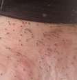 Infestação de mosquitos provoca 'caos' e prefeitura decreta estado de emergência em SC  Foto: Reprodução/NSC