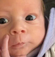 Bebê nasce com os órgãos do lado de fora do corpo  Foto: 
