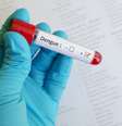 Exame que detecta dengue  Foto: jarun011/iStock