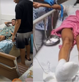 Os influenciadores precisaram ir ao hospital; um permanece internado  Foto: Reprodução/Instagram