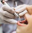 Entenda como evitar o tártaro nos dentes |  Foto: senivpetro/Freepik / Boa Forma