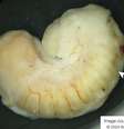 Parasita retirado do olho de uma paciente que comeu carne de crocodilo (Imagem: Van Acker et al, 2024/JAMA Ophthalmology)  Foto: Canaltech