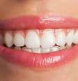 Saiba o que fazer para manter os resultados do clareamento dental |  Foto: asierromero/Freepik / Boa Forma