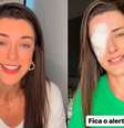 Influencer tem inflamação na córnea após usar cera para cabelo; entenda  Foto: Reprodução Instagram (@bruna.ianhez) / Saúde em Dia