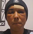 Brasileiro sofre ataque xenofóbico na Irlanda   Foto: Reproduçã/Acervo Pessoal
