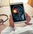 Meningite é um problema grave de saúde pública  Foto: steph photographies | Shutterstock / Portal EdiCase