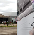 Mãe denuncia que filha teve perna errada operada na Paraíba  Foto: Reprodução/TV Cabo Branco