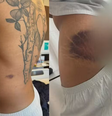 Imagens mostram os hematomas de Danilo, que ficou 6 dias internado  Foto: Reprodução/TV Globo