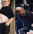 Os gêmeos siameses ​​Ronnie e Donnie Galyon  Foto: Reprodução/Redes Sociais 