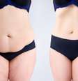 Emagrecimento: 8 dicas para eliminar gordura corporal  Foto: Shutterstock / Saúde em Dia