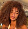 Antes e depois de Brunna Gonçalves: veja como esposa de Ludmilla ficou após diminuir a testa.  Foto: Instagram / Purepeople