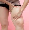 Suplementos podem tratar lipedema? Entenda  Foto: Shutterstock / Saúde em Dia