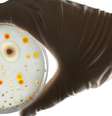 É urgente da necessidade de acelerar os esforços de resistência antimicrobiana  Foto: Canva / Bons Fluidos