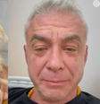 Sem pensão e proibido de falar: os bastidores do divórcio de Ana Hickmann e Alexandre Correa.  Foto: Reprodução, Instagram / Purepeople