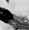 Espermatozoide infectado por covid-19, como mostrado em imagem de microscopia eletrônica (Imagem: Hallak et al./Andrology)  Foto: Canaltech