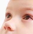 Crianças também têm glaucoma! Entenda a condição  Foto: Shutterstock / Saúde em Dia