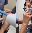 Oftalmologista realizou o procedimento nos Estados Unidos e compartilhou a experiência   Foto: Reprodução/TikTok/@tiagocesarpf