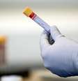 Em uma amostra do sangue, os biomarcadores podem representar uma fotografia do estado bioquímico atual do seu corpo  Foto: PA / BBC News Brasil