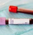 Cientistas analisam o sangue de idosos centenários em busca de biomarcadores relacionados com a probabilidade de viver até os 100 anos (Imagem: Karolina Grabowska/Pexels)  Foto: Canaltech