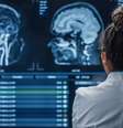 Cerebro  Foto: Getty Images / BBC News Brasil