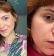 Raíssa está de repouso e espera o resultado da biópsia que sairá em duas semanas  Foto: Reprodução/Instagram/@thatsraissa/X/@raissabulhoes