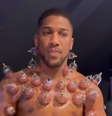 Anthony Joshua surpreende fãs com tratamento   Foto: Reprodução/Instagram/Anthony Joshua