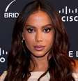 Anitta revela planos para nova cirurgia plástica no rosto e confessa detalhe que a incomoda.  Foto: Getty Images / Purepeople