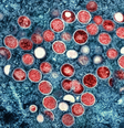 OMS alerta para variante da mpox no Congo (National Institute of Allergy and Infectious Diseases/NIAID  Foto: Canaltech