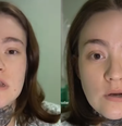Carolina Arruda tem neuralgia do trigêmeo e deixou UTI após alívio de dores  Foto: Reprodução/Iinstagram @caarudar