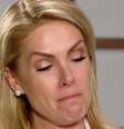 Ana Hickmann afirmou que tentou esconder o hematoma, mas não conseguiu   Foto: Reprodução / Record / RD1