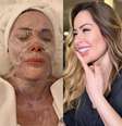 Influenciadora faz tratamento facial à base de cocô de pássaro  Foto: Reprodução / CO - Assessoria