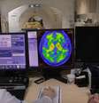 Tratamento para o Alzheimer teve comercialização barrada na Europa por agência reguladora.  Foto: Werther Santana/Estadão / Estadão