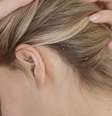 Profissional aponta os tipos de dermatite mais comuns e como evitar a caspa  Foto: Freepik/Divulgação / Boa Forma