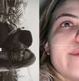 Desabafo da filha de Mingau- Reprodução/Instagram  Foto: Márcia Piovesan