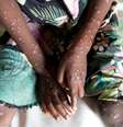 Os surtos de mpox na República Democrática do Congo afetaram tanto crianças como adultos  Foto: Reuters / BBC News Brasil