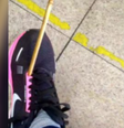 Mulher é atingida por flecha de 60 cm no pé em Belo Horizonte.  Foto: Reprodução/Redes sociais