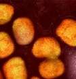 Uma imagem microscópica de partículas do vírus mpox; doença é menos contagiosa que a covid-19  Foto: DW / Deutsche Welle