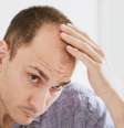 Minoxidil causa impotência / Foto: Shutterstock  Foto: Saúde em Dia