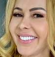O que aconteceu com Joelma? Cantora terá que fazer próximo show de cadeira de rodas; aos detalhes!.  Foto: Reprodução, Instagram / Purepeople
