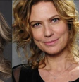 Ana Furtado e Patrícia Pillar venceram a batalha contra o câncer de mama  Foto: Mais Novela