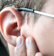 A otosclerose afeta o ouvido médio e pode causar perda de audição progressiva / Foto: Shutterstock  Foto: Saúde em Dia