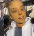 Jovem de 21 anos compartilha sua jornada com quatro doenças autoimunes e crônicas  Foto: Reprodução/Tiktok/@justembasworld