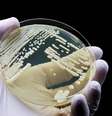 Candida auris é resistente às medicações usadas para combater fungos do mesmo gênero  Foto: TopMicrobialStock
