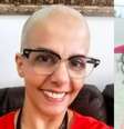 Antes e depois  Foto: Arquivo pessoal