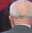 Lula aparece com pontos na cabeça em primeira agenda pública após queda  Foto: Ton Molina/Estadão Conteúdo