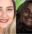 Sabrina Gomes tem doença rara que, entre outros sintomas, alterou a tonalidade de sua pele  Foto: Reprodução / Perfil Brasil