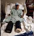 Dylan Riley, 31 anos desenvolveu a Síndrome do Choque Tóxico Estreptocócico (SCTS); infecção começou com um pequeno corte no joelho  Foto: Reprodução/Redes Sociais 