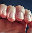 Unhas mal cuidadas  Foto: Freepik / Manequim